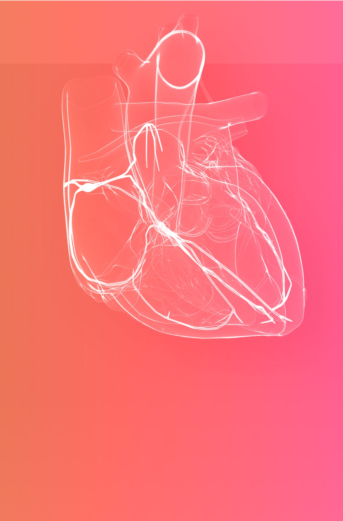 Left ventricular hypertrophy